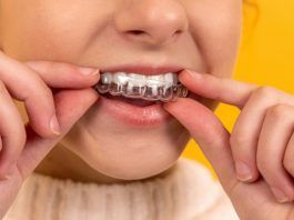 Un primer plano muestra a una persona colocando un alineador de ortodoncia transparente sobre sus dientes superiores sobre un fondo amarillo vivo, resaltando la precisión y el cuidado típicos de una clínica dental de renombre.