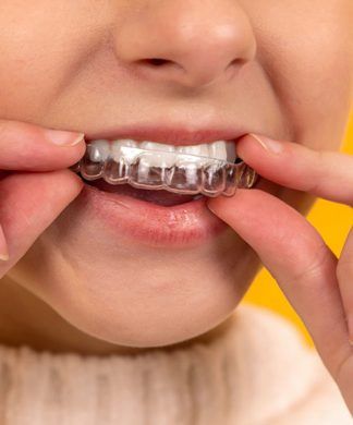 Un primer plano muestra a una persona colocando un alineador de ortodoncia transparente sobre sus dientes superiores sobre un fondo amarillo vivo, resaltando la precisión y el cuidado típicos de una clínica dental de renombre.